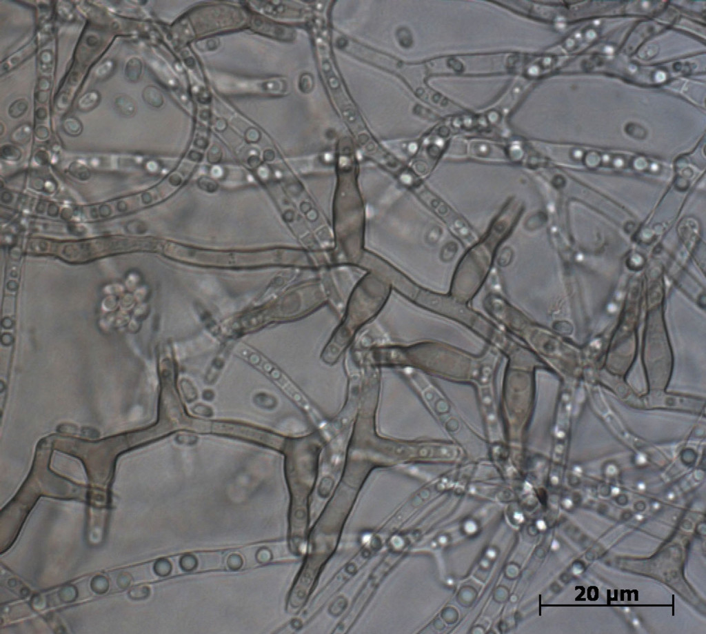 The fungal pathogen Chalara fraxinea under a microscope