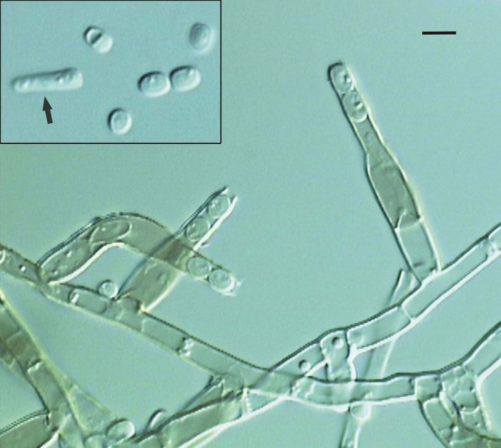 The fungal pathogen Chalara fraxinea under a microscope close up